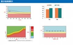 骨密度檢測(cè)報(bào)告T值為多少可以檢查為骨密度