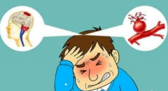 心腦血管疾病癥狀，經(jīng)顱多普勒盡早檢查