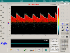 腦彩超tcd儀?一場(chǎng)腦檢查帶來(lái)的科技風(fēng)暴