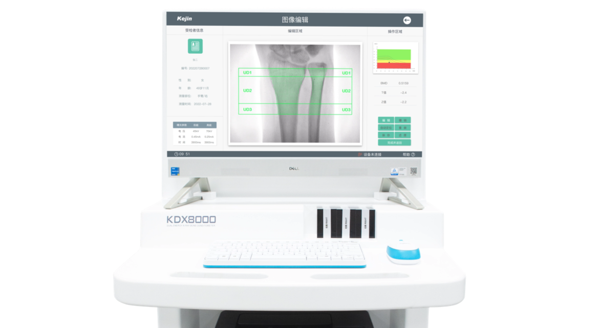 雙能X射線骨密度儀KDX8000系列應用示意圖